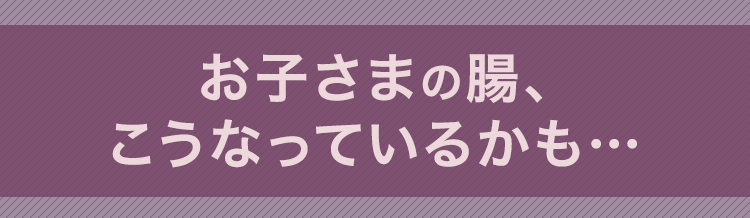 お子さまの腸、こうなっているかも…